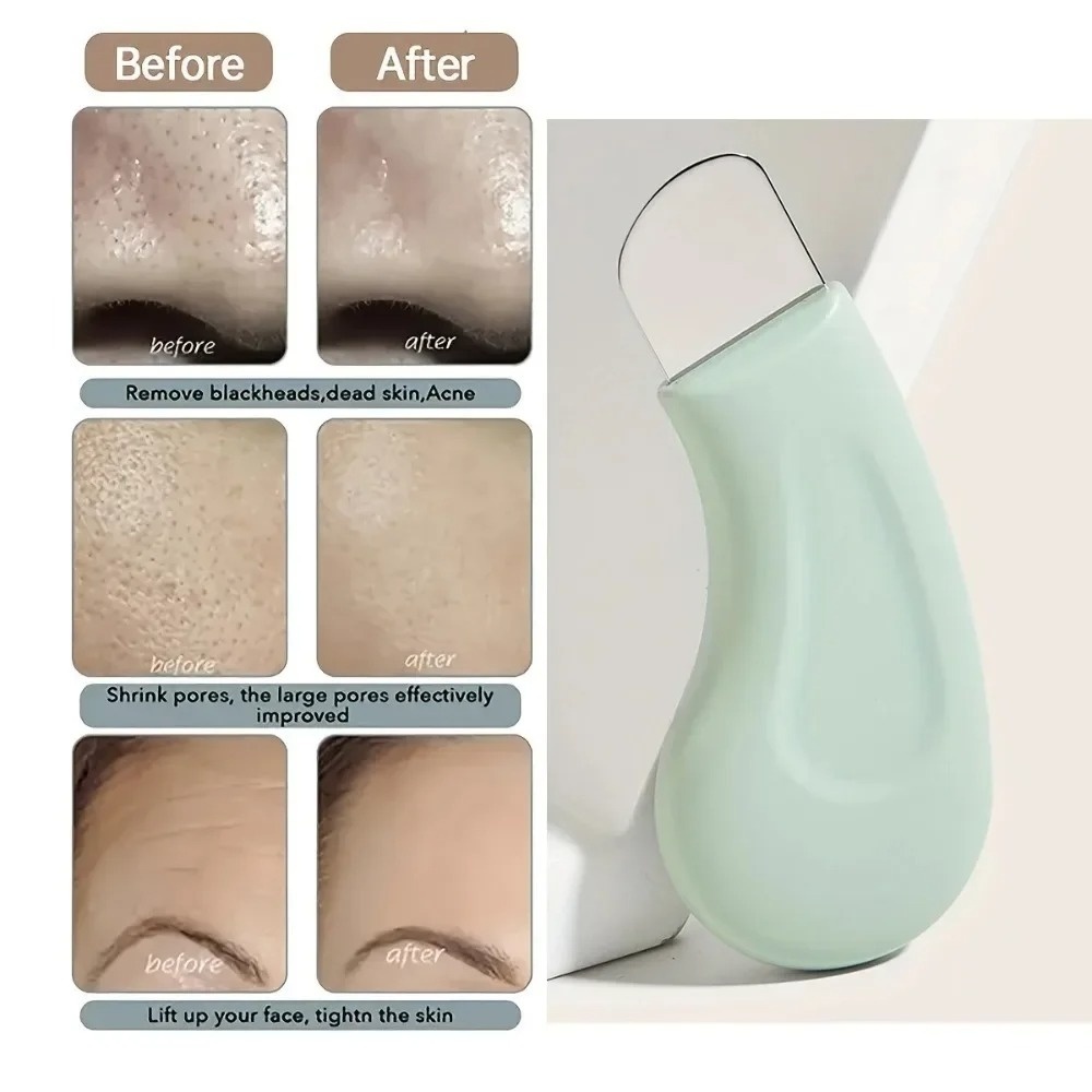 Dieptereinigende siliconen gez - Skincare Routine recensie en prijs