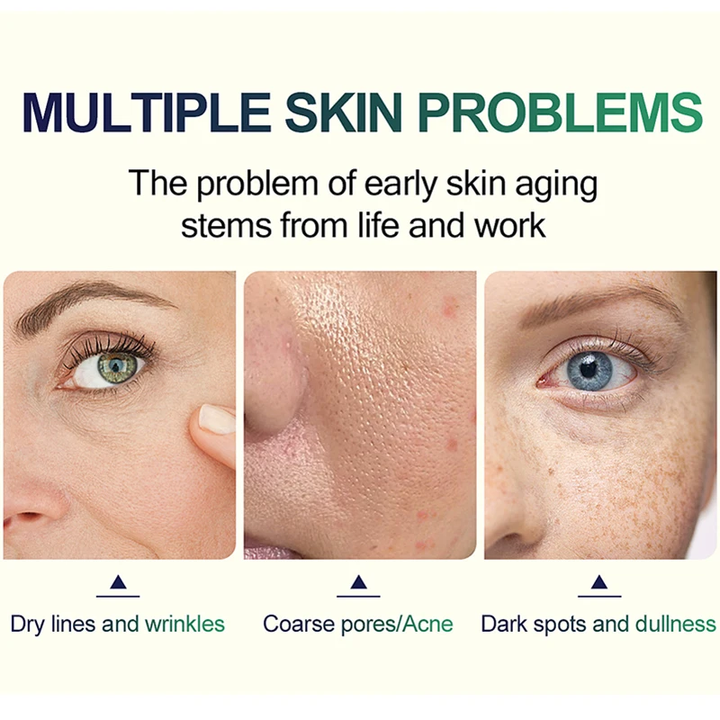 Superforce TCA Peel Acid Chemi - Hyaluronic Acid Serum recensie en prijs